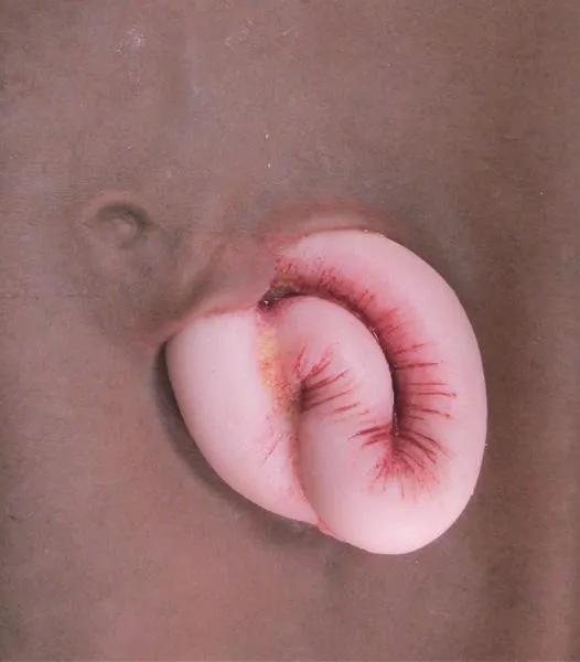 Wearable Wounds Evisceration